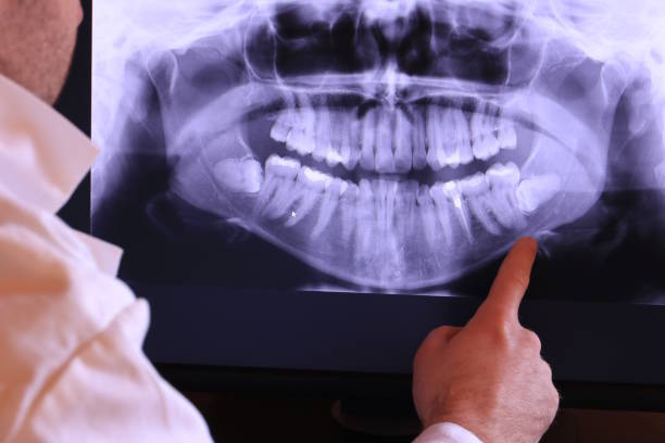 Best Emergency Dental Services for Seniors in Munising, MI