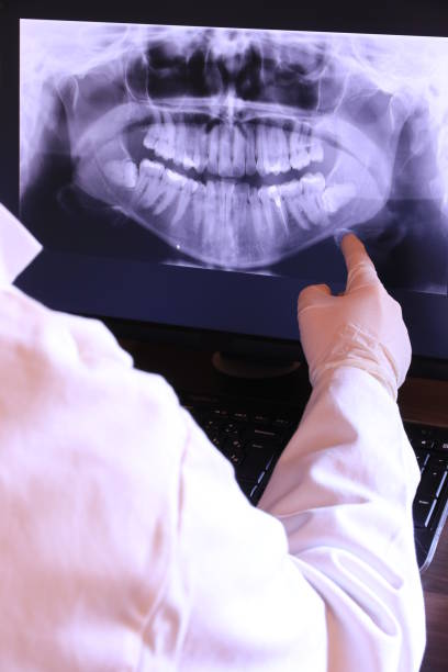 Best Emergency Dental Care for Abscessed Tooth in Munising, MI